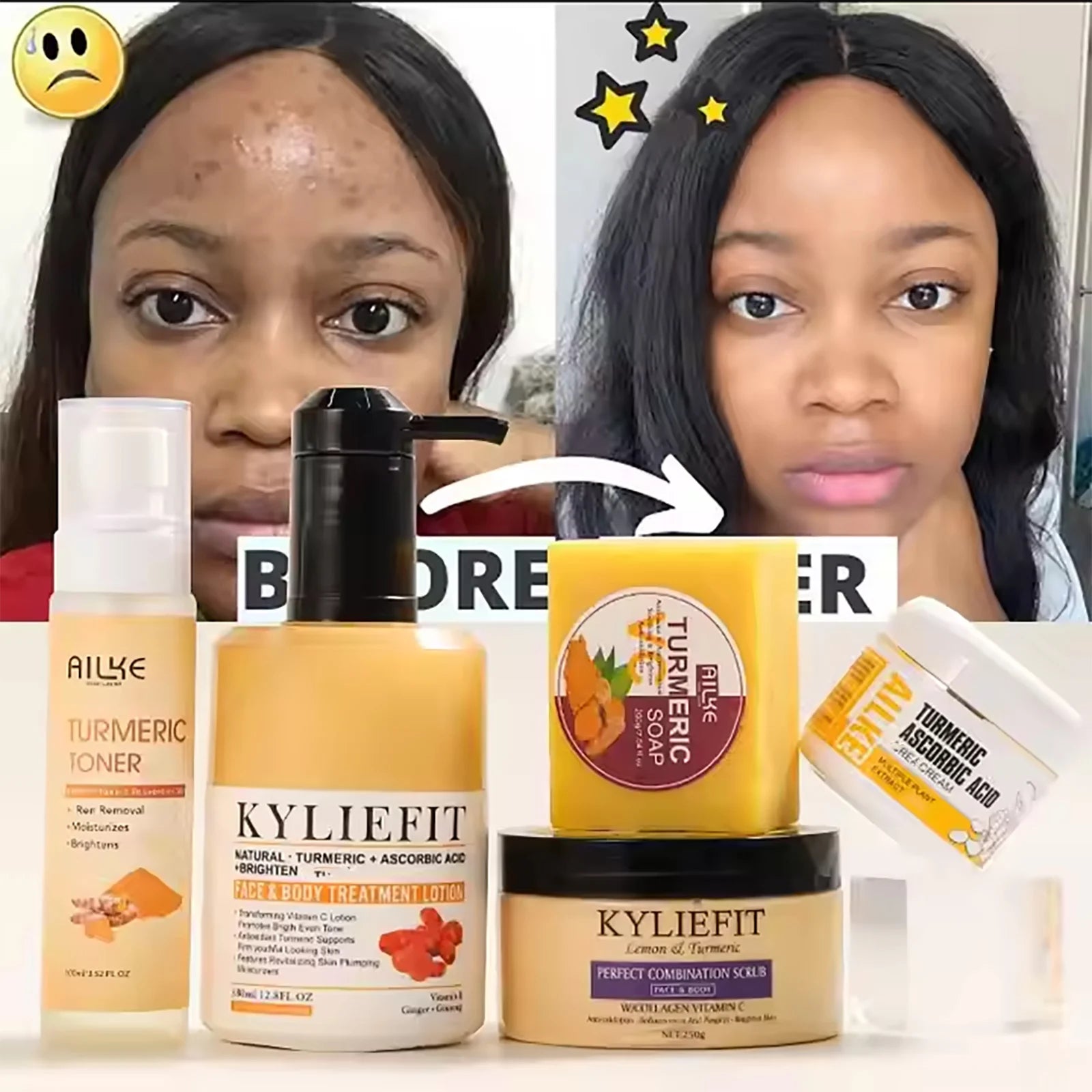 Organic Turmeric Skin Care Kit, Brighten, Clean, Remove Darkness, Spots, Acne, Lighten, Hydration, Exfoliate, Even Skin Tone