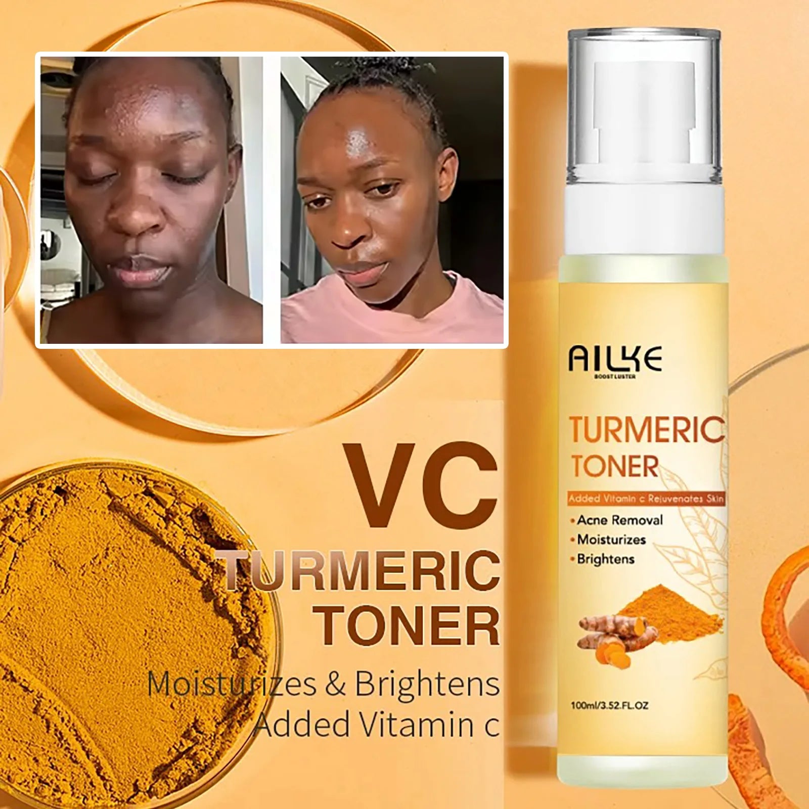 Organic Turmeric Skin Care Kit, Brighten, Clean, Remove Darkness, Spots, Acne, Lighten, Hydration, Exfoliate, Even Skin Tone