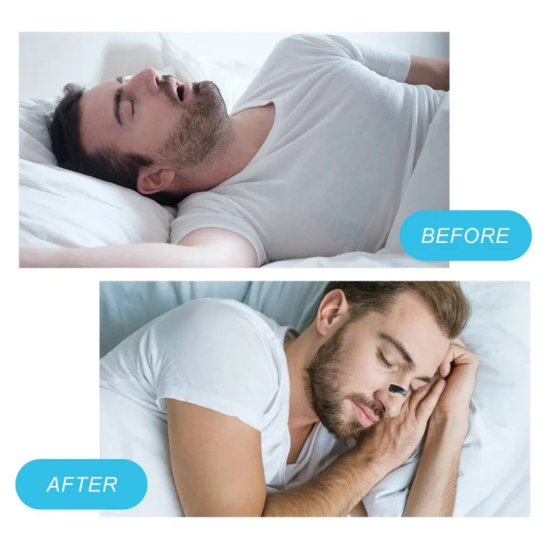 Magnetic Nasal Dilator Starter Kits Increase Air Intake Improve Sleeping Reduce Snoring Breathing Refill Nose Clip