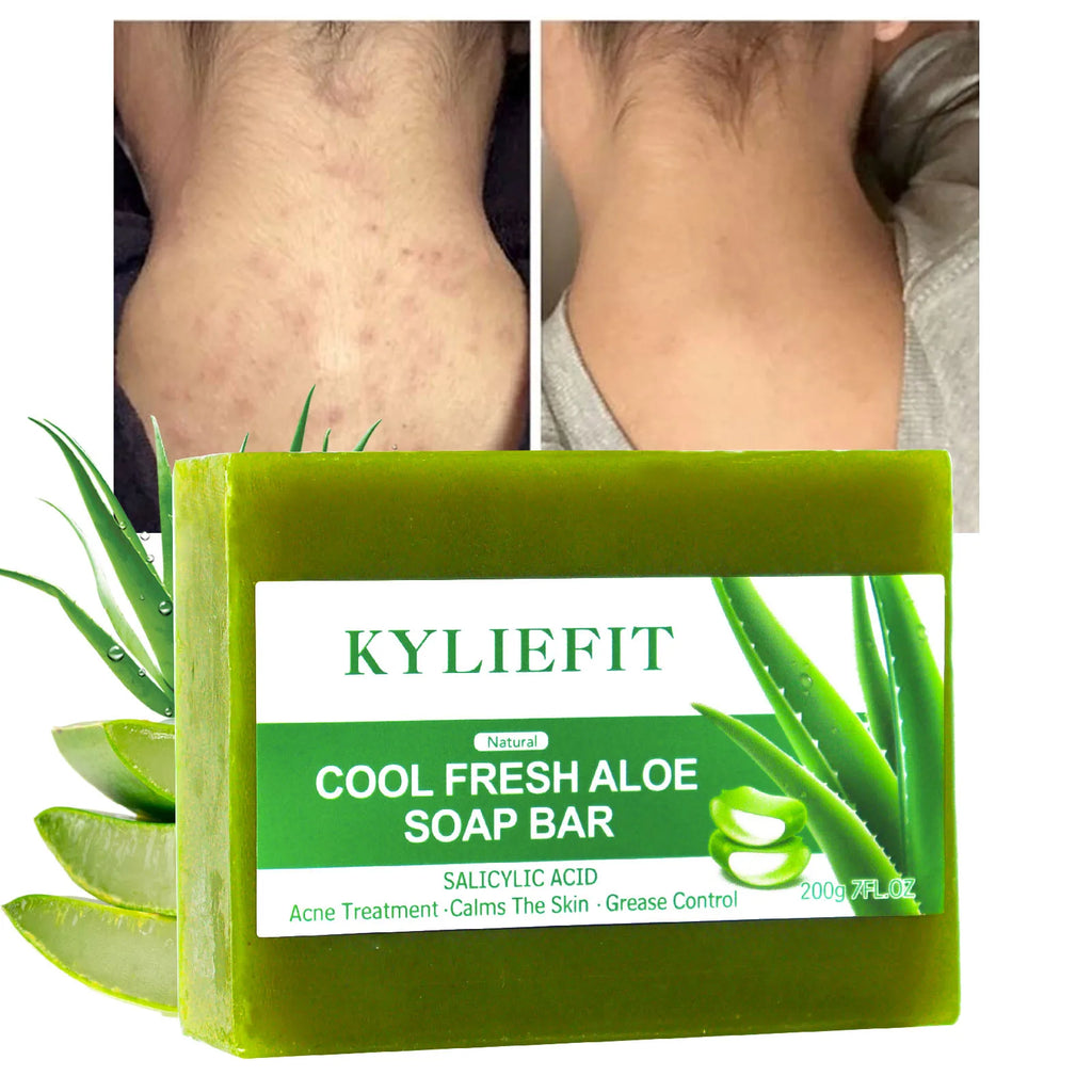 Aloe Brightening Soap Bar, Remove Dark Spots, Sun Spots, Acne, Oil Control, Clean Stains, Exfoliation, For Face and Body, 200g