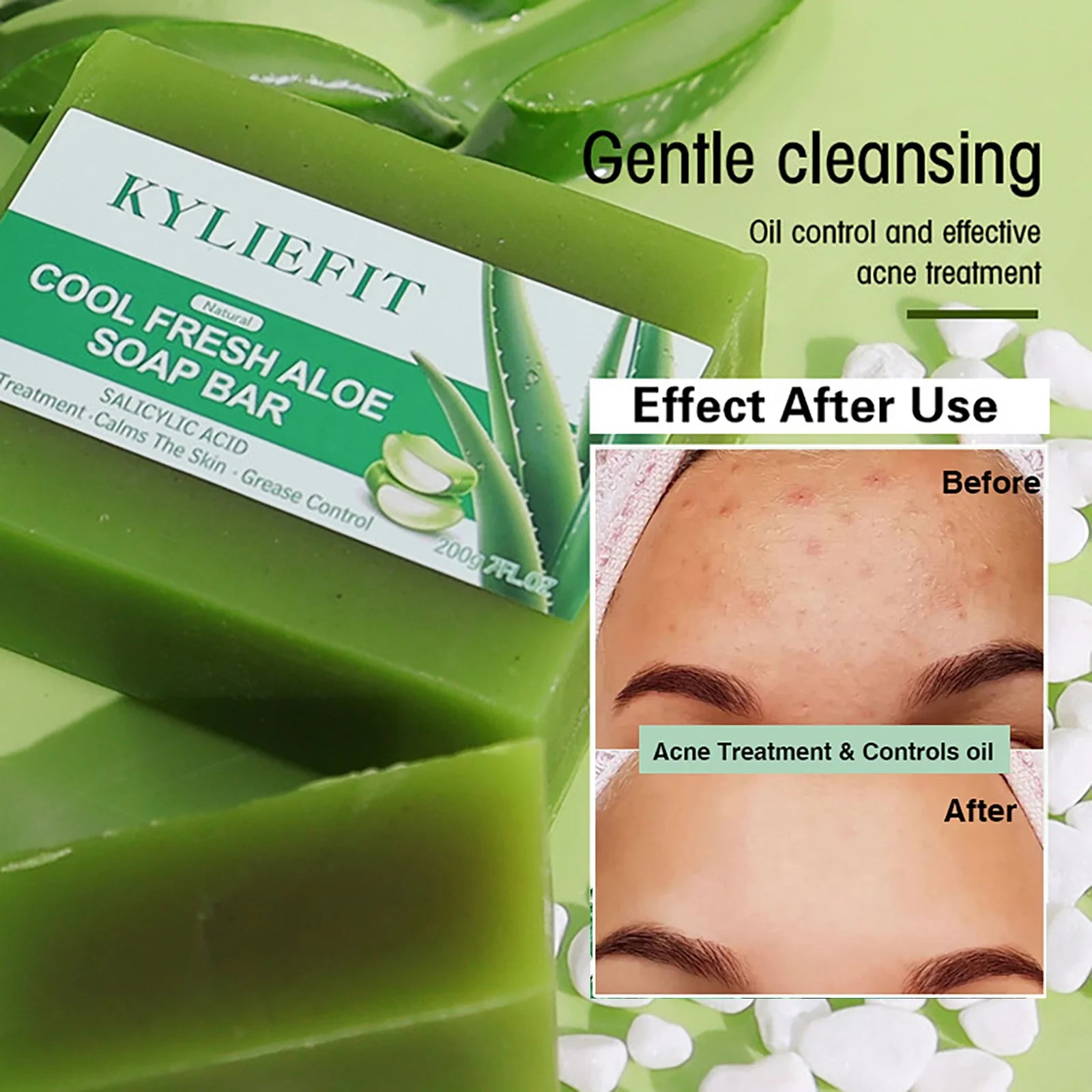 AILKE Aloe Vera Whitening Soap, Remove Acne, Spots, Skin Radiant, Improve Skin Luster, Vegan Bath Wash for All Skin Types, 200g