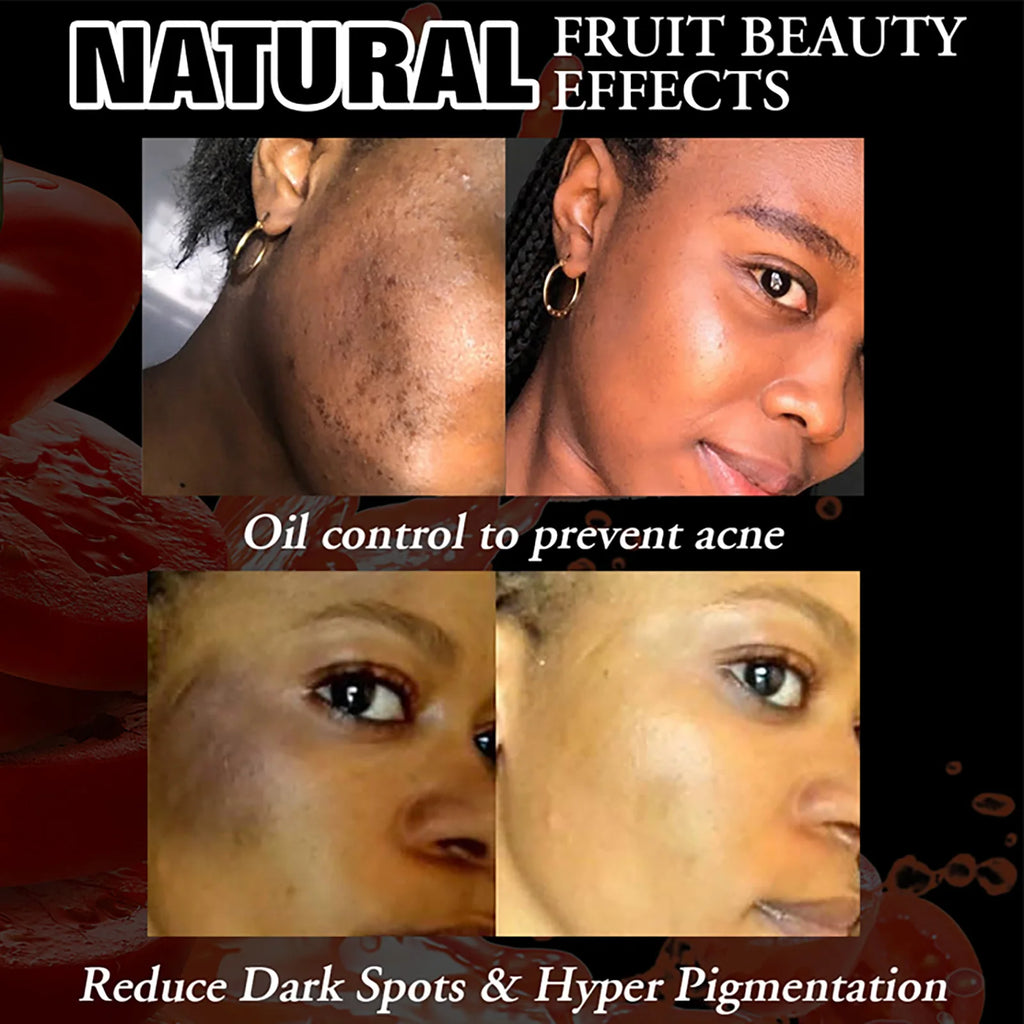 AILKE Organic Tomato Soap Bar, Lightening Skin, Deeply Clean, Exfoliate, Remove Dark Spots, Moisturizing, For Face, Body, 200g