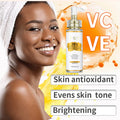 AILKE Lightening Body Cream, With Vitamin C, Hyaluronic Acid, Shea Butter, Reduce Black Spots, Even Skin Tone, Hydration Lotion